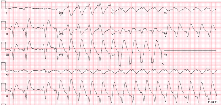 Hone Your ECG-Interpreting Skills with the Clinical ECG Qbank ...