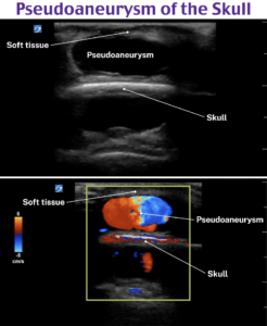 Qbank For The Abem Advanced Em Ultrasonography Examination - Roshreview.com