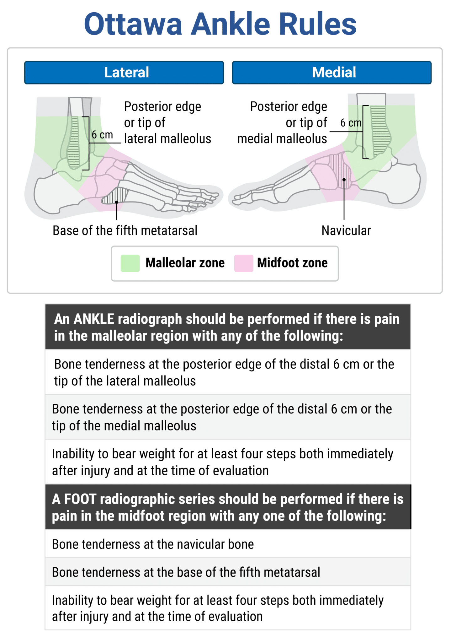 Rapid Review: Ottawa Ankle Rules - RoshReview.com