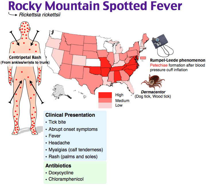 Rapid Review Rocky Mountain Spotted Fever RoshReview Com   Image Rocky Mountain Spotted Fever RMSF 