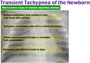 Rapid Review: Transient Tachypnea of the Newborn - RoshReview.com