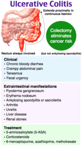 Rapid Review: Ulcerative Colitis - RoshReview.com