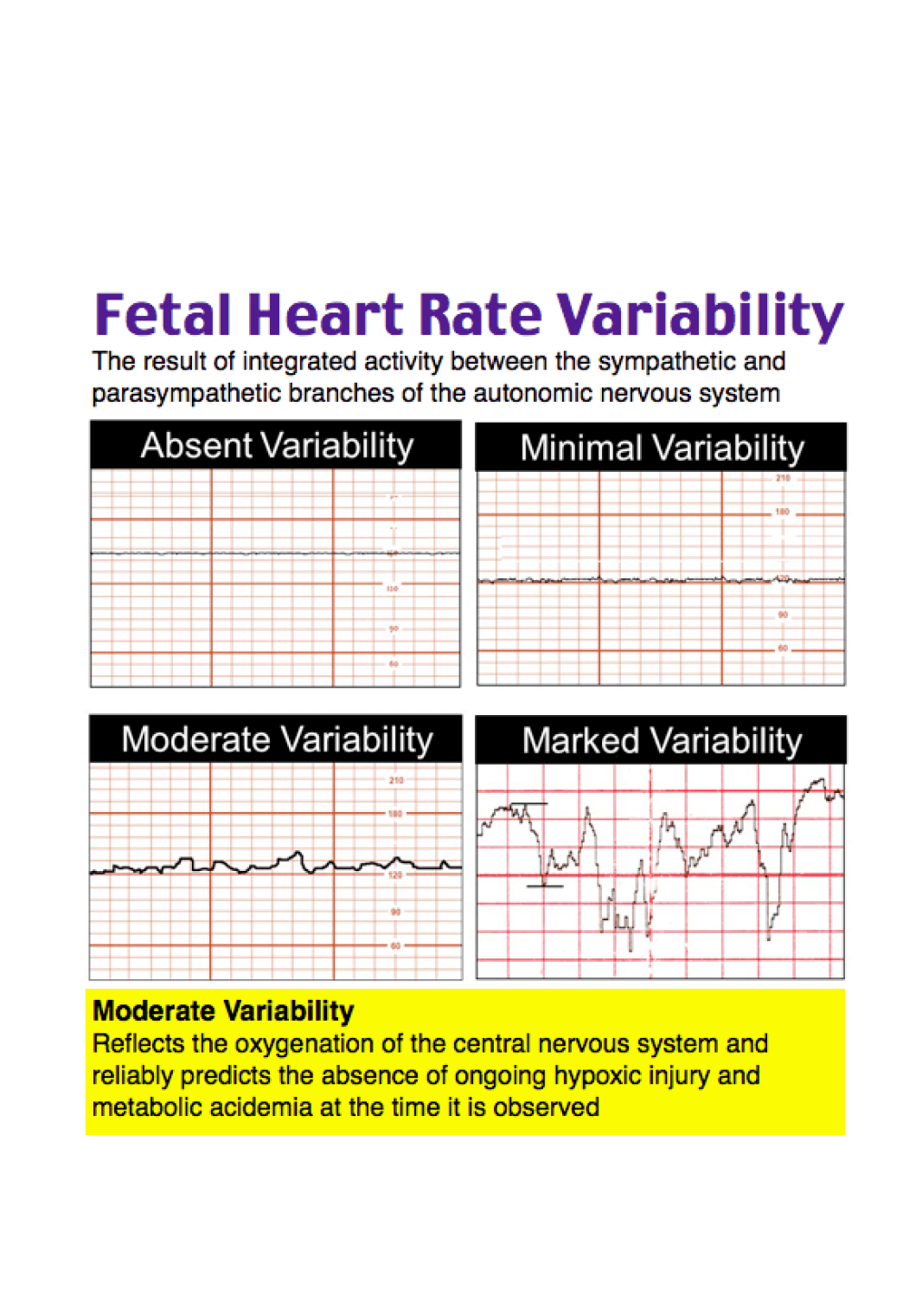 RoshReview Electronic Fetal Heart Rate Monitoring Rosh Review