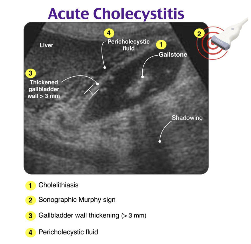 Build your foundation in the core elements of point-of-care ultrasound