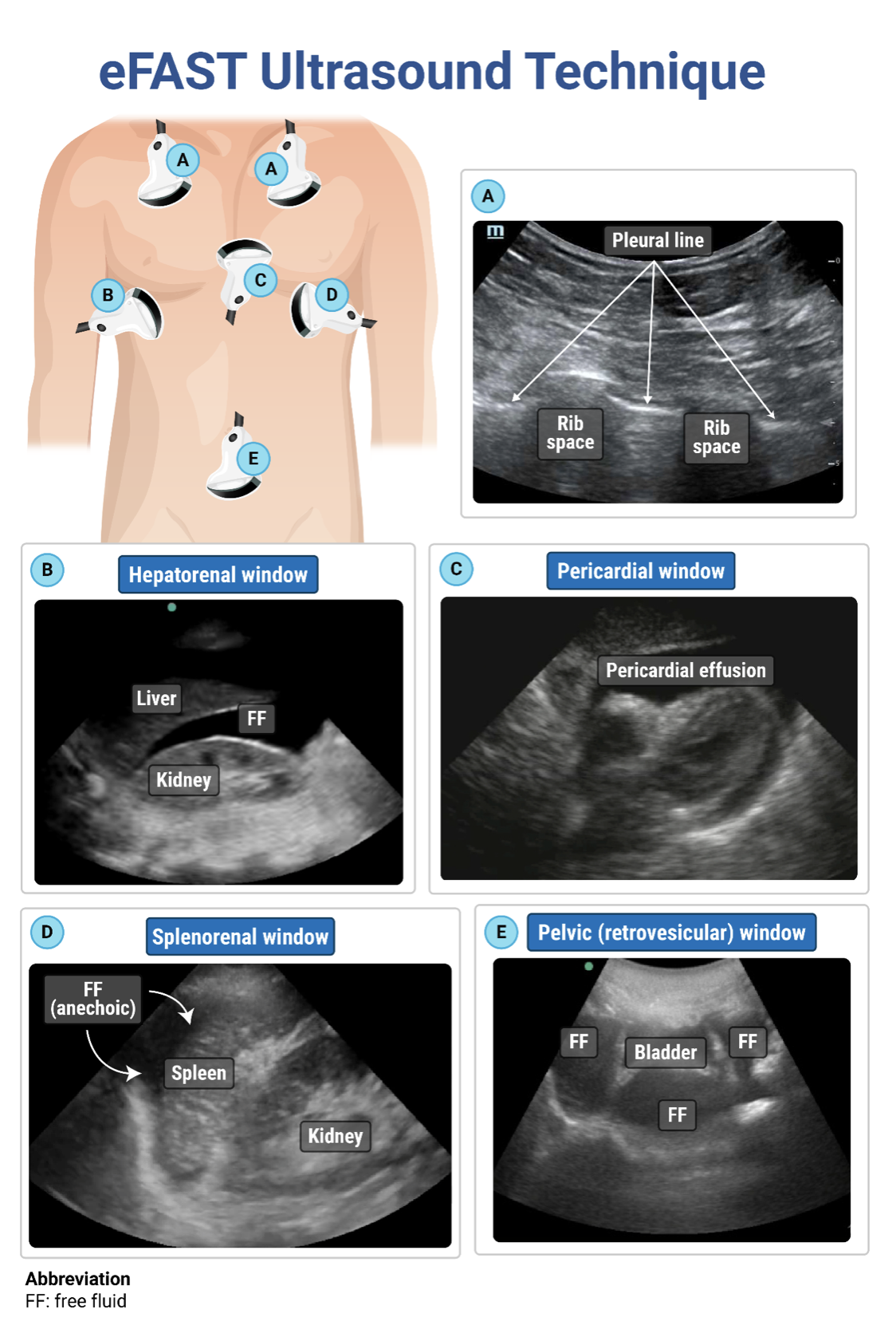 Learn to use POCUS across a wide range of clinical scenarios