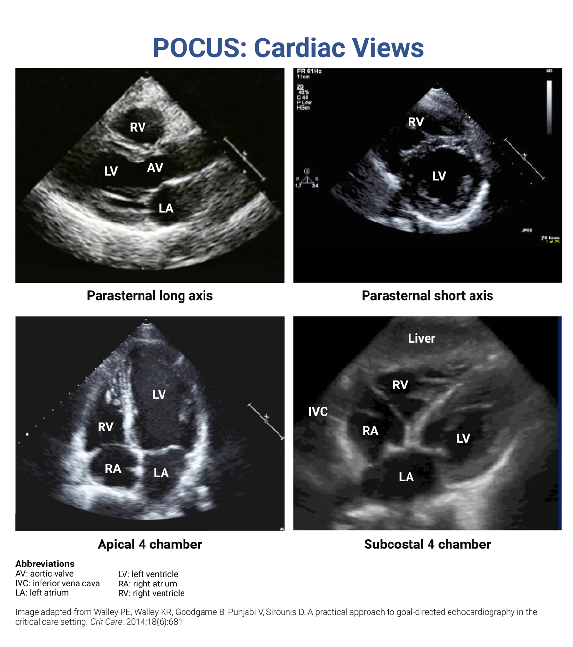 Incorporate ultrasound imaging using best practice guidelines