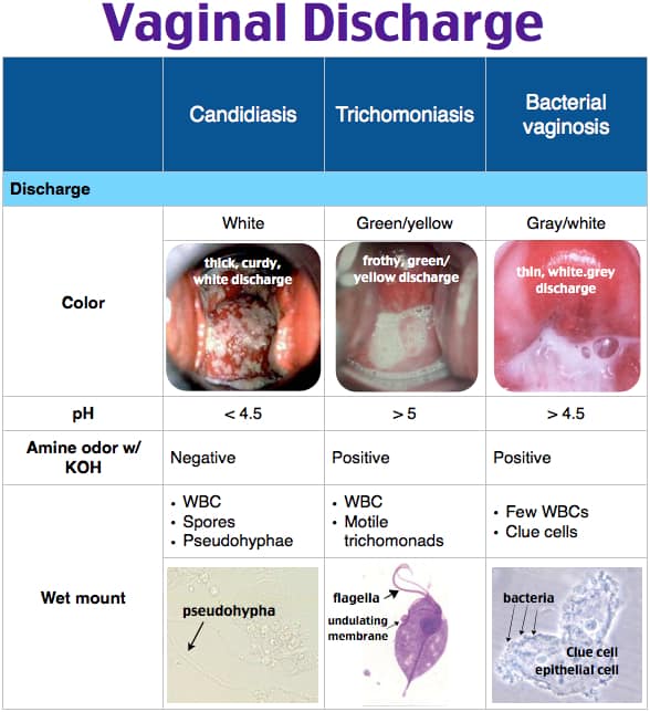 Vaginal Candidiasis